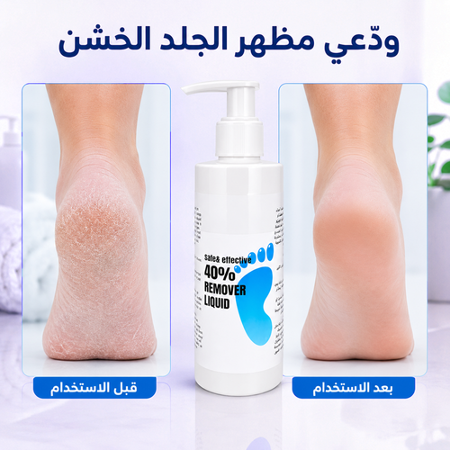 أزاله الجلد الميت والزوائد Callus remover gel 250ML
